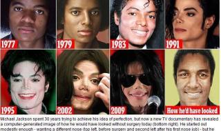 迈克尔杰克逊的皮肤 迈克尔杰克逊的皮肤