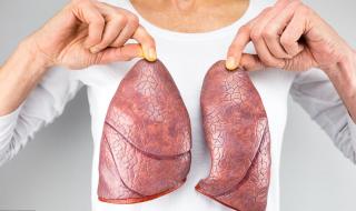 卡介苗是预防什么病 卡介苗是预防什么病